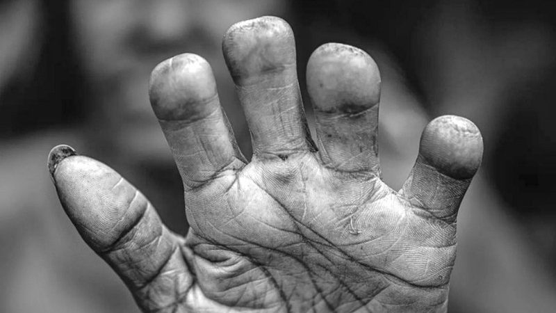 Tradisi Potong Jari Suku Dani Papua, Ritual Ekstrem yang Menyimpan Makna Kasih Sayang dan Kepercayaan