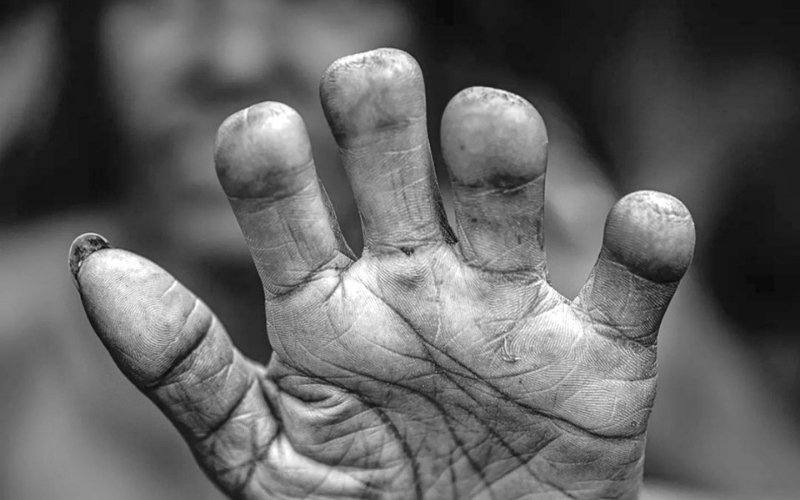 Tradisi Potong Jari Suku Dani Papua, Ritual Ekstrem yang Menyimpan Makna Kasih Sayang dan Kepercayaan
